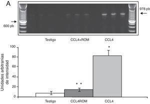 Niveles de ARNm de NR1 en la corteza prefrontal de la rata. A) Fotografía de gel representativo de los diferentes grupos de trabajo. Media±DST de 4 experimentos por duplicado. *p<0,05 CCL4 vs. T. **p<0,05 CCL4+ROM vs. CCL4.