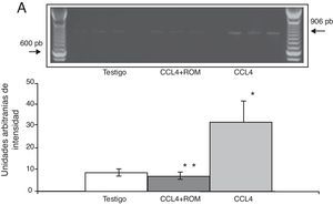 Niveles de ARNm de NR2A en la corteza prefrontal de la rata. A) Fotografía de gel representativo de los diferentes grupos de trabajo. Media±DST de 4 experimentos por duplicado. *p<0,05 CCL4 vs. T. **p<0,05 CCL4+ROM vs. CCL4.
