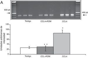 Niveles de ARNm de NR2B en la corteza prefrontal de la rata. A) Fotografía de gel representativo de los diferentes grupos de trabajo. Media±DST de 4 experimentos por duplicado. *p<0,05 CCL4 vs. T. **p<0,05 CCL4+ROM vs. CCl4.