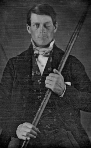 Daguerrotipo de Phineas Gage (fotografía perteneciente a la colección de Jack y Beverly Wilgus.