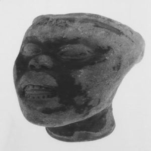 Representación de un individuo con características de síndrome de Down de la cultura Tumaco–La Tolita (300 aC - 600 dC). Museo del Oro, Bogotá, Colombia.