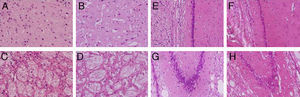 Tinciones con hematoxilina-eosina de cortes coronales de la corteza (A,B), el cuerpo cuerpo estriado (C,D), CA1 (E,F) y CA3 (G,H) a 40× de magnificación. Los paneles de la izquierda muestran las secciones correspondiente a los animales controles y los de la derecha pertenecen a animales con hipoperfusión cerebral de 7 días de evolución.