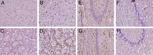 Microfotografías representativas de secciones coronales de cerebros de ratas con inmunotinciones a la proteína fibrilar acídica de la glía en la corteza (A,B) el cuerpo estriado (C,D), CA1 (E,F) y CA3 (G,H) a 40× de magnificación. Los paneles de la izquierda muestran las secciones correspondiente a los animales controles y los de la derecha pertenecen a animales con hipoperfusión cerebral de 7 días de evolución.