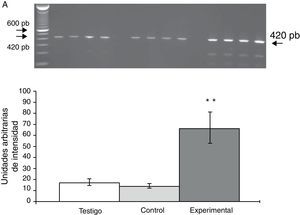 Niveles de ARNm de α4 en la CPF dorsomedial de ratas con lesión del núcleo del rafe dorsal. A) Fotografía de gel representativo de los diferentes grupos de trabajo. Los datos se expresaron como la media±DE de 4 experimentos por duplicado. p<0,05. **T vs E;+T vs C.