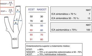 Metodología en la cuantificación de la estenosis carotídea según los estudios NASCET y ECST, resultados principales y beneficio de la endarterectomía carotídea.