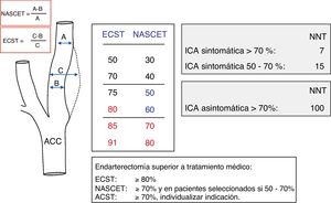 Metodología en la cuantificación de la estenosis carotídea según los estudios NASCET y ECST, resultados principales y beneficio de la endarterectomía carotídea.