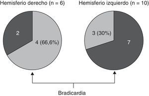 Bradicardia en los pacientes con DFT sin tratamiento bradicardizante que mostraron en la resonancia magnética atrofia muy lateralizada a un hemisferio cerebral.
