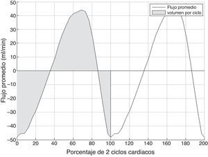 Curva típica de flujo promedio obtenida en el acueducto de Silvio durante 2 ciclos cardiacos consecutivos. Los valores positivos indican flujo caudocraneal y los valores negativos flujo craneocaudal. El área sombreada indica el volumen por ciclo.