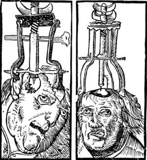 Trepanación medieval.