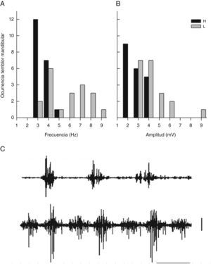 A) Frecuencia (Hz) de la actividad EMG del músculo temporal durante el temblor mandibular en ratas con haloperidol (H) y con lesión electrolítica del EVL (L). B) Amplitud (mV) de la actividad EMG del músculo temporal durante el temblor mandibular en ratas con haloperidol y con lesión electrolítica en el EVL. C) Trazos de actividad EMG de un segundo, obtenidos durante los movimientos mandibulares en un grupo de ratas tratadas con haloperidol (H) y con lesión del EVL (L). Calibración horizontal: 200ms. Calibración vertical: 1mV.