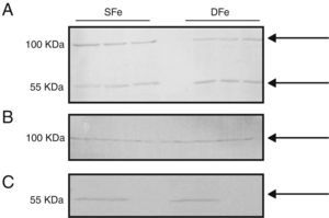 Expresión de IGF-I en cultivos celulares del SNC de ratones BALB/c por western-blot. (A) Cultivos mixtos de células gliales, (B) cultivos de células de la microglía, (C) cultivos de células neuronales. Cultivos con hierro suficiente (SFe) o con hierro deficiente (DFe). Las flechas indican las bandas detectadas por el anticuerpo.