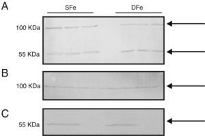 Expresión de IGF-I en cultivos celulares del SNC de ratones BALB/c por western-blot. (A) Cultivos mixtos de células gliales, (B) cultivos de células de la microglía, (C) cultivos de células neuronales. Cultivos con hierro suficiente (SFe) o con hierro deficiente (DFe). Las flechas indican las bandas detectadas por el anticuerpo.