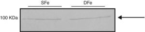 Análisis de la expresión de IGF-IR en cultivos celulares del SNC de ratones neonatos BALB/c por western-blot. Cultivos con hierro suficiente (SFe) o hierro deficiente (DFe). La flecha indica IGF-IRβ.