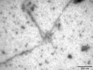 Fibras de Aβ42 caracterizadas como amiloide por microscopia electrónica de transmisión.