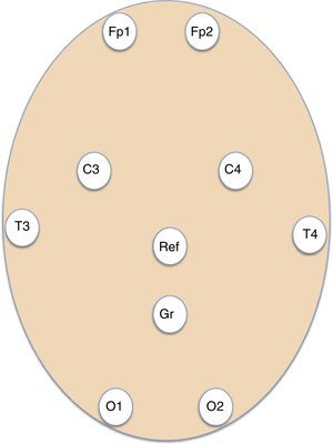 Esquema que muestra la disposición de los electrodos adhesivos para el montaje básico de 8 canales EEG de los registros de EEG urgentes. C: parietal; Fp: frontopolar; Gnd: ground (tierra); O: occipital; Ref: referencial; T: temporal.
