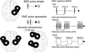 Esquema iconográfico de las modalidades de aplicación de la EMT: pulsos simples, pulsos apareados en una o 2 áreas diferentes del cerebro y EMTr (lenta —de baja frecuencia— ≤ 1Hz y rápida —de alta frecuencia— ≥ 5Hz). ®: respuesta. Adaptada con permiso de Pascual-Leone et al., 200815.