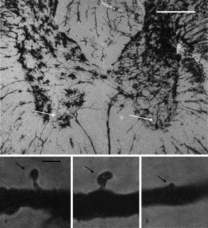 Panel superior: fotomicrografía panorámica de las astas dorsales y ventrales de un segmento torácico de la médula espinal de rata, impregnada mediante una modificación al método de Golgi. Las fleches señalan motoneuronas en el asta ventral, en cuyas dendritas primarias se realizaron los conteos de espinas. Escala: 100μm. Panel inferior: fotomicrografías representativas de una espina delgada (d), una en hongo (h) y una gorda (g) (flechas), como aquellas que se contaron en este estudio. Escala: 2μm.