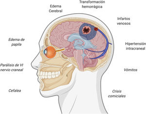 Síntomas y eventos fisiopatogénicos implicados en la trombosis de senos venosos cerebrales. Figura creada con BioRender.com.