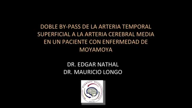 https://ars.els-cdn.com/content/image/1-s2.0-S0213485318301798-mmc1.mp4