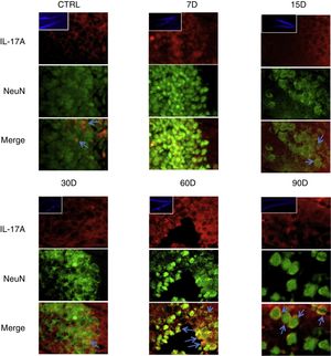 Efecto de la exposición crónica a bajas dosis de ozono sobre la expresión de IL-17A en neuronas. Doble marca de fluorescencia en el hipotálamo de ratas expuestas a bajas dosis de ozono durante 7, 15, 30, 60 y 90 días. Las neuronas están marcadas en color verde y la IL-17A en rojo. Las imágenes muestran el giro dentado a un aumento de 100×, mientras que los recuadros muestran la misma estructura a una magnificación de 10×. Las flechas azules indican una doble expresión de marcadores. Obsérvese que a los 60 y 90 días de exposición se presenta mayor inmunorreactividad a IL-17A por las neuronas del giro dentado. Barra de escala=20μm.