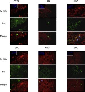 Efecto de la exposición crónica a bajas dosis de ozono sobre la expresión de IL-17A en astrocitos. Doble marca de fluorescencia en el hipotálamo de ratas expuestas a bajas dosis de ozono durante 7, 15, 30, 60 y 90 días. Los astrocitos están marcados en color verde y la IL-17A en rojo. Las imágenes muestran el giro dentado a un aumento de 100×, mientras que los recuadros muestran la misma estructura a una magnificación de 10×. Las flechas azules indican una doble expresión de marcador. Obsérvese que a los 90 días de exposición se presenta mayor inmunorreactividad a IL-17A por los astrocitos del giro dentado. Además, nótese el aumento en el número de astrocitos y la longitud de las prolongaciones de los 15 a los 90 días de exposición. Barra de escala=20μm.