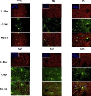 Efecto de la exposición crónica a bajas dosis de ozono sobre la expresión de IL-17A en microglía. Doble marca de fluorescencia en el hipotálamo de ratas expuestas a bajas dosis de ozono durante 7, 15, 30, 60 y 90 días. Las células microgliales están marcadas en color verde y la IL-17A en rojo. Las imágenes muestran el giro dentado a un aumento de 100×, mientras que los recuadros muestran la misma estructura a una magnificación de 10×. Las flechas azules indican una doble expresión de marcadores. Obsérvese que a los 15 días de exposición se presenta mayor inmunorreactividad a IL-17A por la microglía del giro dentado. Barra de escala=20μm.