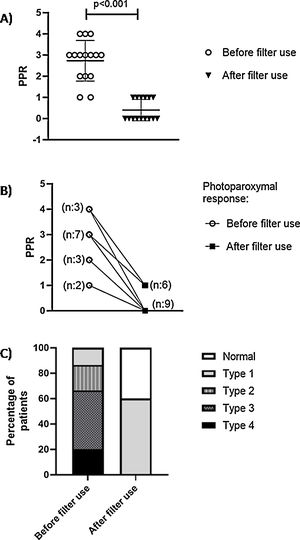 (A) PPR response using Waltz types grouped by filter use (percentage of patients), PPR distribution: (B) Mean and SD, (C) change of the PPR response before and after filter use.