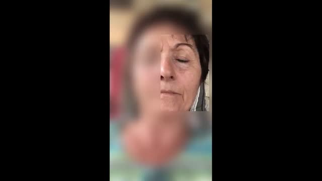 https://ars.els-cdn.com/content/image/1-s2.0-S0213485321000967-mmc1.mp4