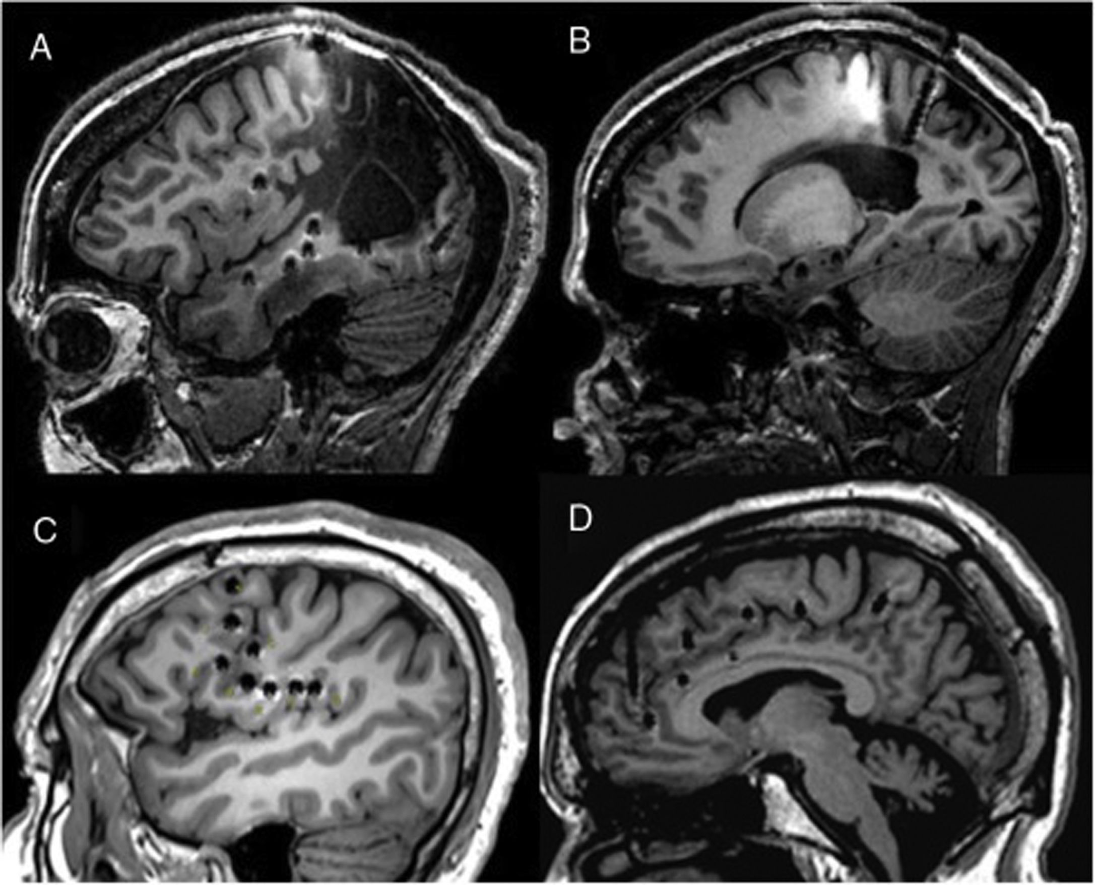 fig0015