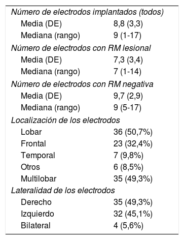 Tablas