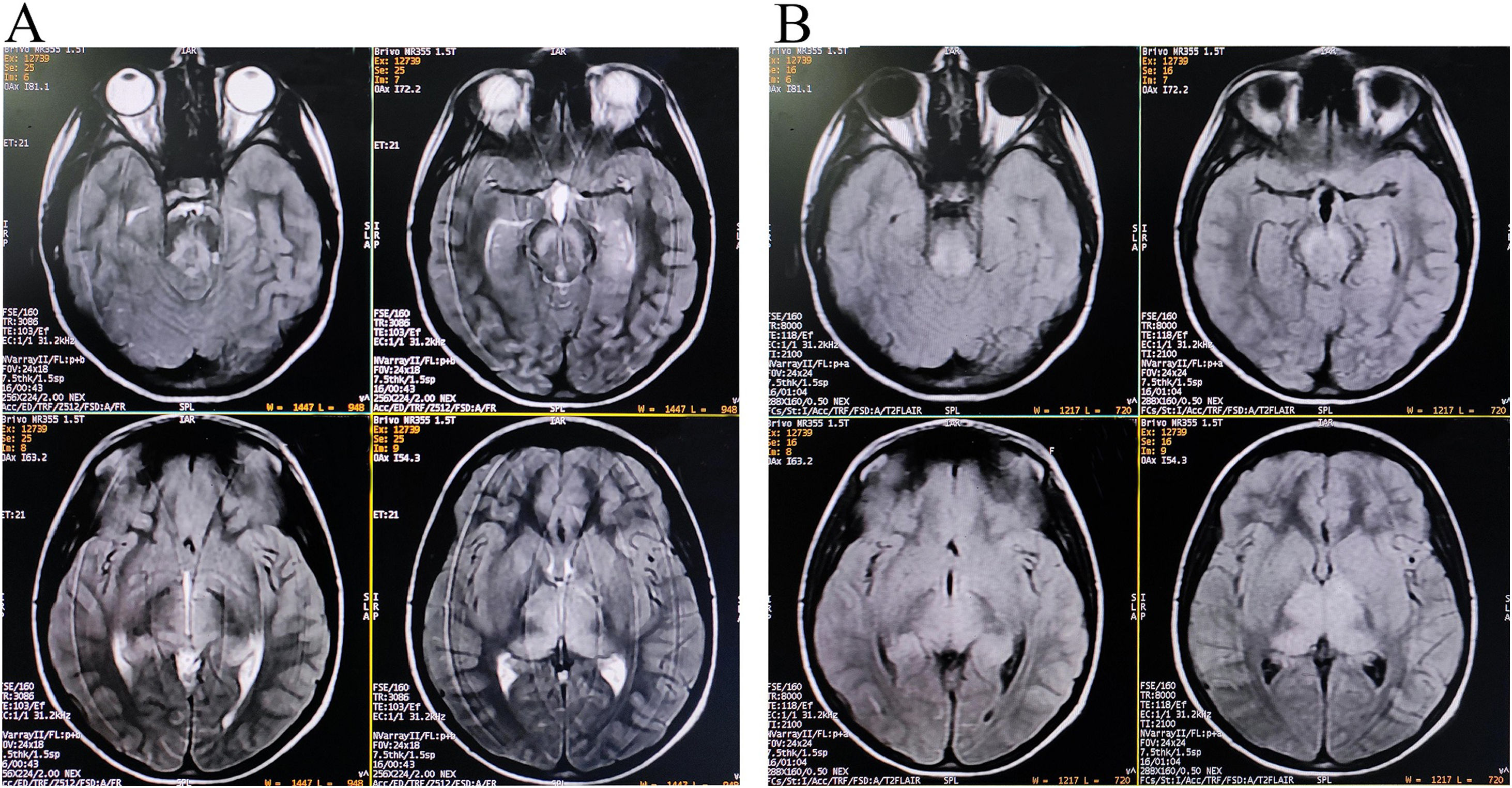 fig0005