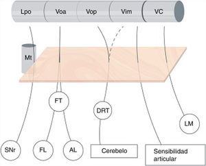 Subdivisión del tálamo motor y sus aferencias. Se ilustran las conexiones aferentes al tálamo ventral. Nótese que dichas proyecciones atraviesan el área subtalámica posterior – recuadro naranja-, y están íntimamente relacionadas con el haz mamilotalámico en su parte más anterior. No existe una clara división de las aferencias cerebelosas que llegan a través del tracto dentato-rubro-talámico hacia Vop y Vim, mientras que la frontera entre tálamo motor y sensitivo (VC) está bien delimitada. AL: Ansa Lenticularis; DRT: Tracto Dentato-rubro-talámico; FL:Fasciculus Lenticularis; FT: Fasciculus Thalamicus; LM: Lemnisco Medial; Lpo: Lateropolaris; Mt: Haz mamilo-talámico; SNr: Sustancia nigra pars reticulata; VC: Ventro Caudalis; Vim: Nucleus Ventralis intermedius; Voa: Ventralis oralis anterior; Vop: Ventralis oralis posterior.