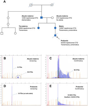 Árbol genealógico y electroferogramas de casos con protomutación y mutación completa respectivamente. En la parte superior, electroferograma de los test Screening y Confirmatory del abuelo materno. En la parte inferior, electroferogramas de los test Screening y Confirmatory del caso índice.