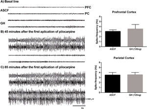 Effect of growth hormone (GH, 120ng) on electrographic activity recorded from Prefrontal (PFC) and Parietal (PC) cortex during the status epilepticus (SE) induced by lithium–pilocarpine. (A) Basal line, (B) Electrographic activity 45min after the first application of pilocarpine (the rat injected with artificial cerebrospinal fluid [ACSF] is already in SE), (C) Electrographic activity 85min after the first application of pilocarpine (at this time, both rats have electrographic and behavioral SE). Graphs on the right panel show the spike frequency during the first generalized electrographic seizure recorded in the PFC and PC after the injection of ACSF or GH. Data are expressed as the mean±S.E.M. and were analyzed by a Student