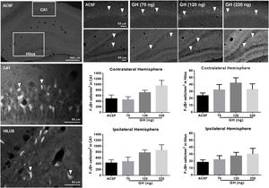 Effect of growth hormone (GH) on hippocampal neurodegeneration after status epilepticus (SE) induced by lithium–pilocarpine. Microphotographs show Fluoro-Jade B positive (F-JB+) cells (in white) in the dorsal hippocampus of rats treated with artificial cerebrospinal fluid (ACSF) (upper left side panels) or GH (70, 120, or 220ng) (upper right side panels). Arrowheads in high and low magnification microphotographs point to F-JB+ cells in CA1 and the hilus. Original pictures were converted to 8-bit greyscale images with Fiji. The graphs represent the number of FJ-B+ cells/mm2 in CA1 and the hilus for each experimental group. Data are expressed as the mean±S.E.M. and were analyzed by a one-way ANOVA. No difference between experimental groups was identified.