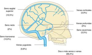 Frecuencia de afectación de los senos y venas cerebrales en la población estudiada. Adaptada de Mawet J, Crassard I, Bousser M.G. Thromboses veineuses cérébrales. EMC (Elsevier Masson SAS, Paris), Traité de Médecine Akos, 5-0885, 2010.
