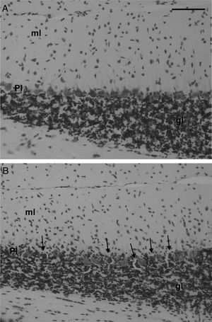 Representative photomicrographs of the cerebellar cortex stained with cresyl violet. The spherical cell bodies of the Purkinje cells in the Saline control rats (A) are regularly aligned in the Purkinje cell layer (Pl) between the granular (gl) and molecular (ml) layers. In the 3-AP-treated rats (B), the Purkinje cell somata were shrunken, hyperchromatic, and scattered (arrows) within the Purkinje cell layer. Scale bar=150μm.