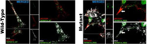 Confocal microscopy images of cells transfected with the TNFRSF1A (WT gene) and the TNFRSF1A-R92Q (MT gene). The expression of EGFP coupled to the WT gene and mutant gene in HOG cells is observed, as well as the analysis of the expression of GRP78-BiP (endoplasmic reticulum [ER], protein involved in the correct folding of proteins and degradation of misfolded proteins) and WGA (membrane marking). It is interesting that the expression of TNFRSF1A (WT) was mainly in the cell membrane, whereas TNFRSF1A-R92Q (mutant) expression formed small precipitates in the endoplasmic reticulum (arrows), which are also positive for WGA; these possibly correspond to non-functional/misfolded protein inclusions in the cytoplasm, since GRP78-BiP, also known as HSPA5 (heat shock protein family A, member 5), is considered an essential ER chaperone and a master regulator of ER homeostasis. GRP78 facilitates the folding and assembly of nascent polypeptides, prevents their misfolding and aggregation, targets misfolded proteins for proteasome degradation, and controls signaling for the initiation of the various arms of the unfolded protein response.