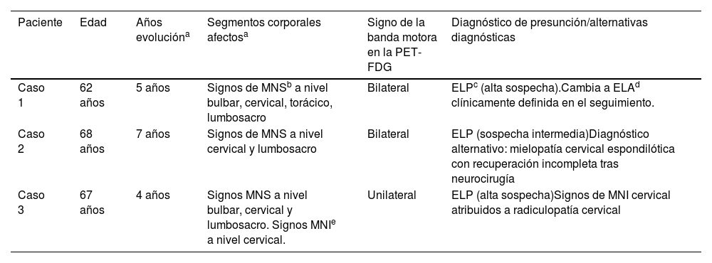 Tablas