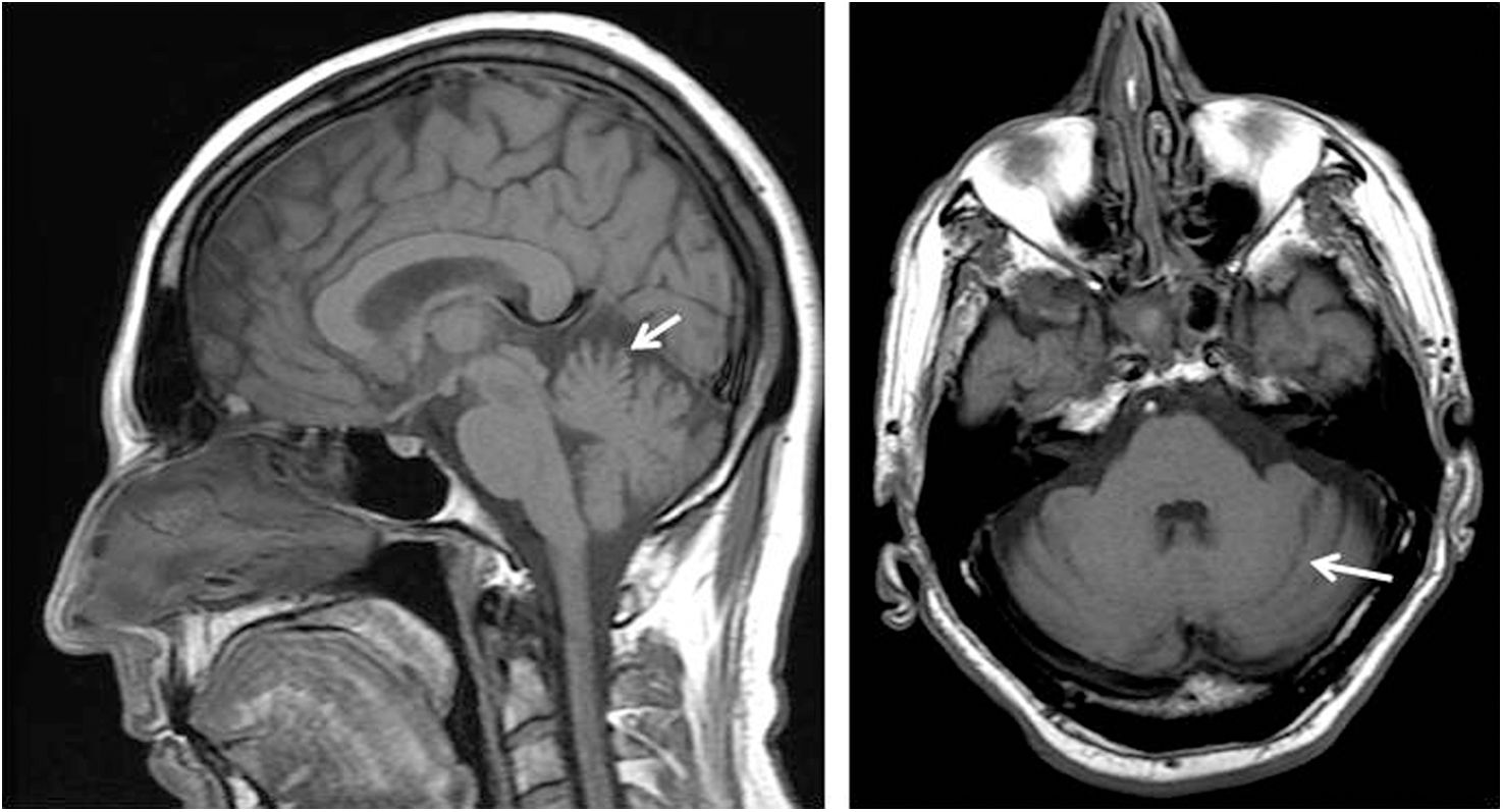 fig0005