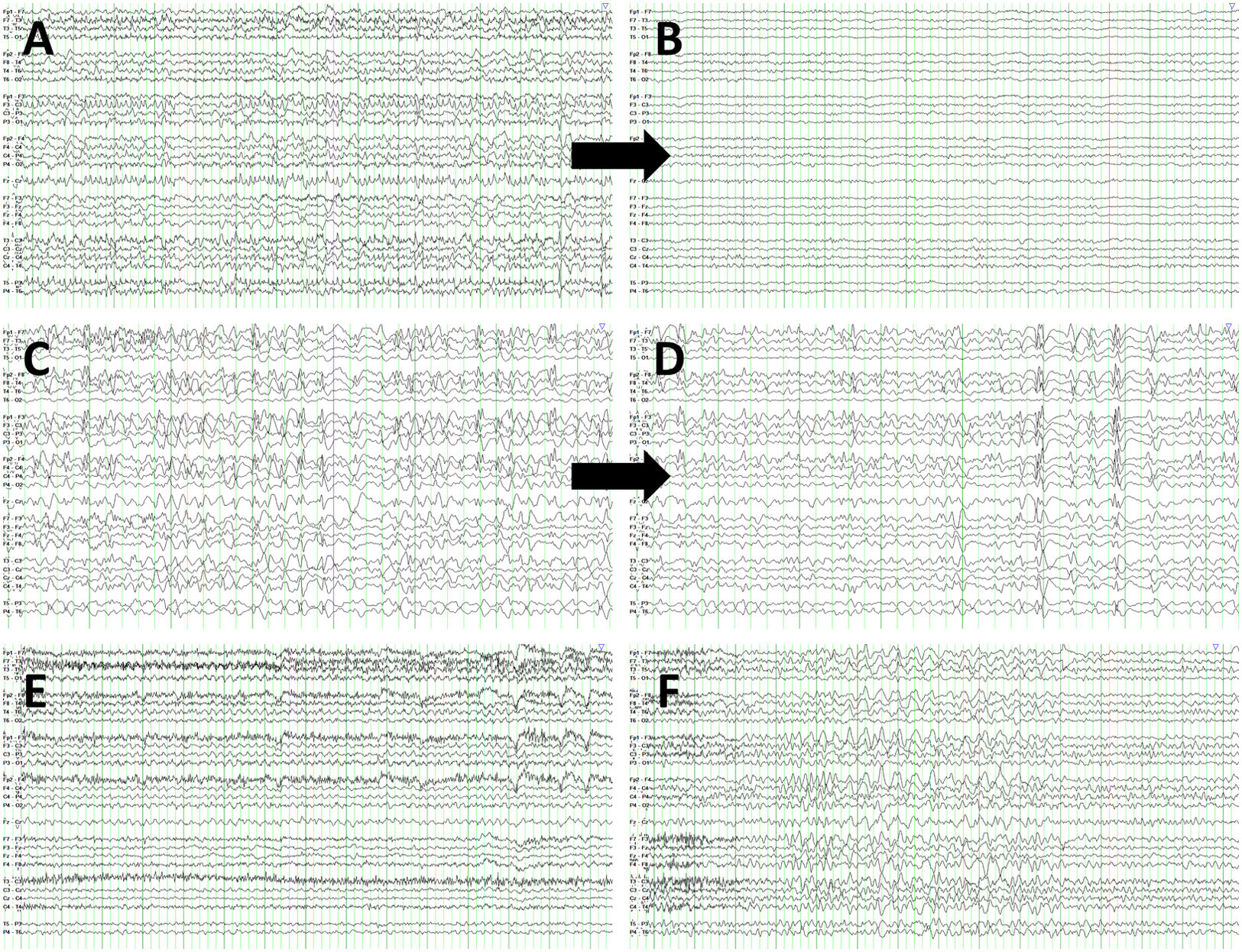 fig0020