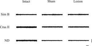 Multiunit activity traces of basal activity (resting state) obtained of the record in the granular layer of the lobes Sim B and Crus II, as well as of the DN of the cerebellum for every experimental group; the intact, sham, and lesion. Horizontal calibration: 500ms. Vertical calibration: 1mV.