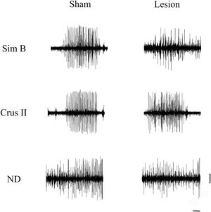 Multiunit activity traces of 5s were obtained during jaw tremor movement of rats belonging to the sham and lesion groups. Horizontal calibration 500ms. Vertical calibration: 1mV.