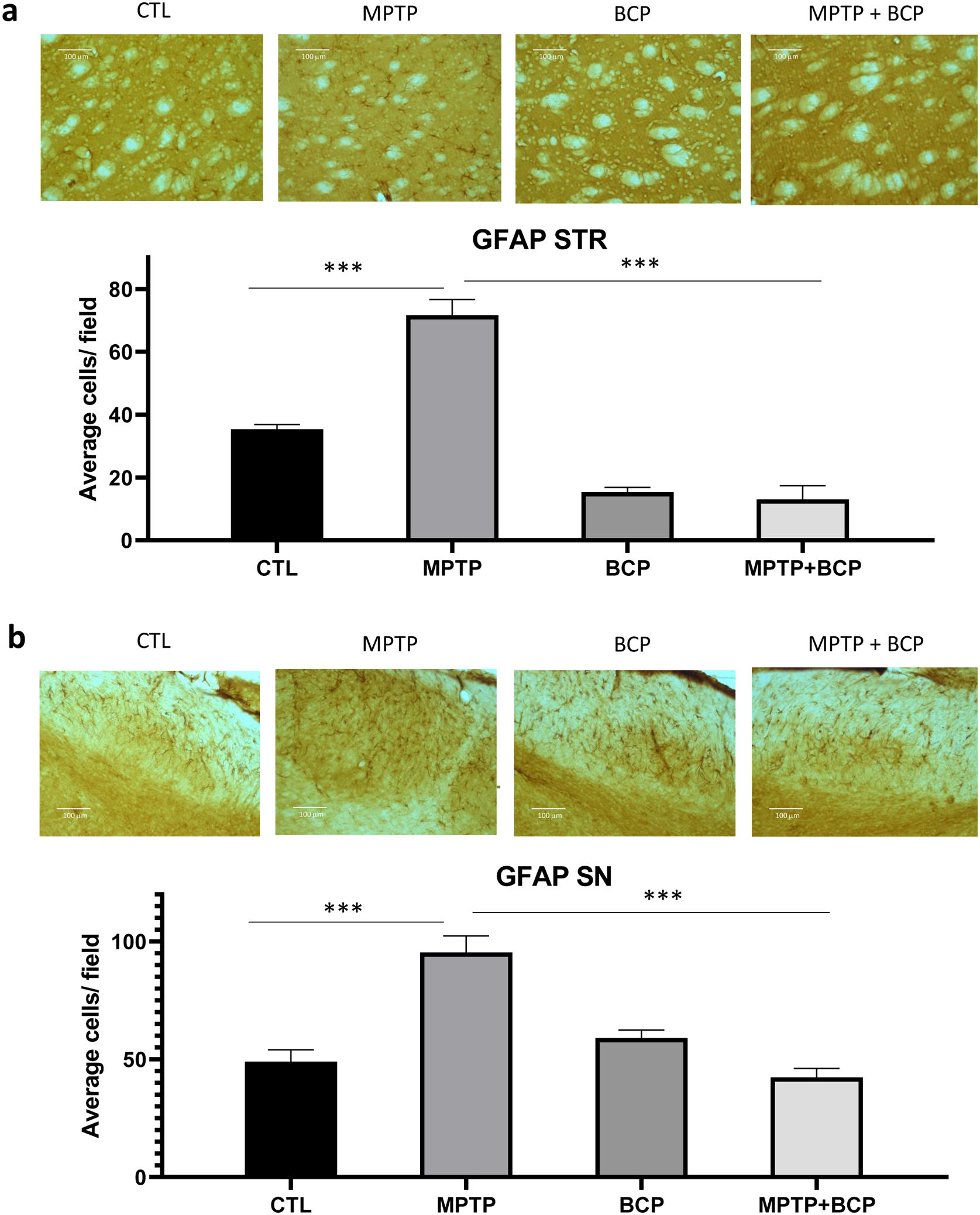 Beta-caryophyllene inhibits the permeability of the blood–brain barrier ...