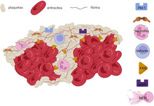 Esquema de la composición del trombo que muestra la interfaz entre áreas ricas en plaquetas/fibrina y 2 áreas ricas en eritrocitos. En el seno de las áreas ricas en plaquetas se sitúan múltiples agentes inflamatorios y hemostáticos implicados en la formación del mismo.