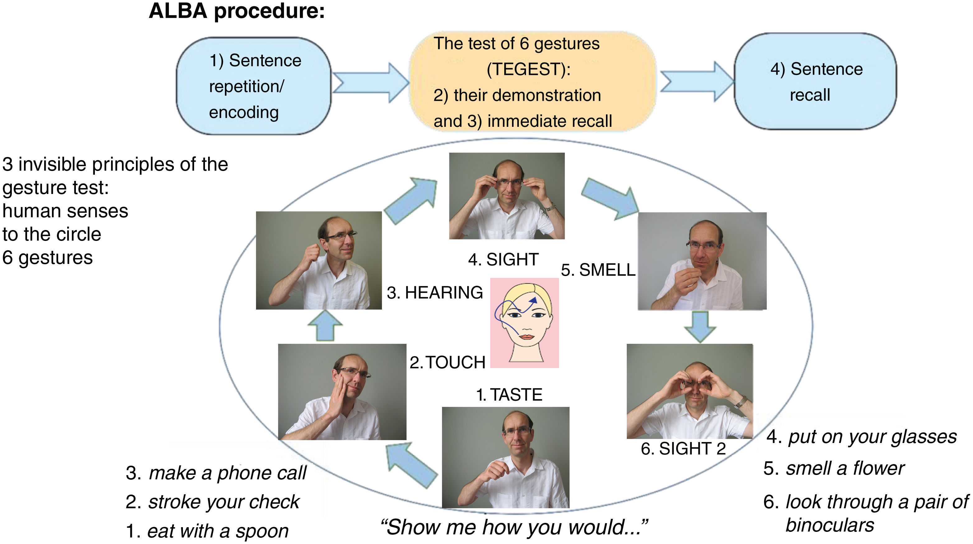 The sensitive Amnesia Light and Brief Assessment (ALBA) is a valid 3 ...
