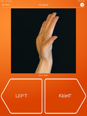Ensayo del paradigma de discriminación izquierda-derecha de la Hand Laterality Task a través de la Recognise App™19,51 para la medición del esquema corporal. El sujeto debe indicar lo más rápido posible si la mano que aparece es izquierda o derecha. La imagen es original y corresponde a una captura de pantalla de uno de los estímulos presentados al azar en la pantalla de «test rápido».