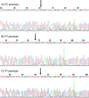 Sequencing of rs6265 genotypes PCR amplification.