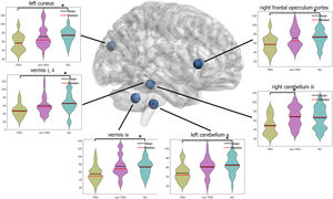 Comparison of degree centrality among the three groups.
