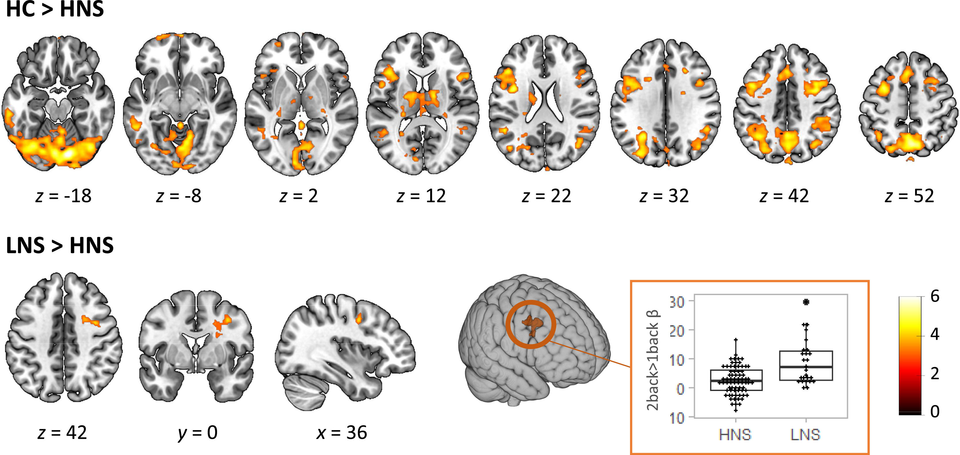 Functional Brain Imaging Of Negative Symptoms In Schizophrenia Further functional-brain-imaging-of-negative-symptoms-in-schizophrenia-further